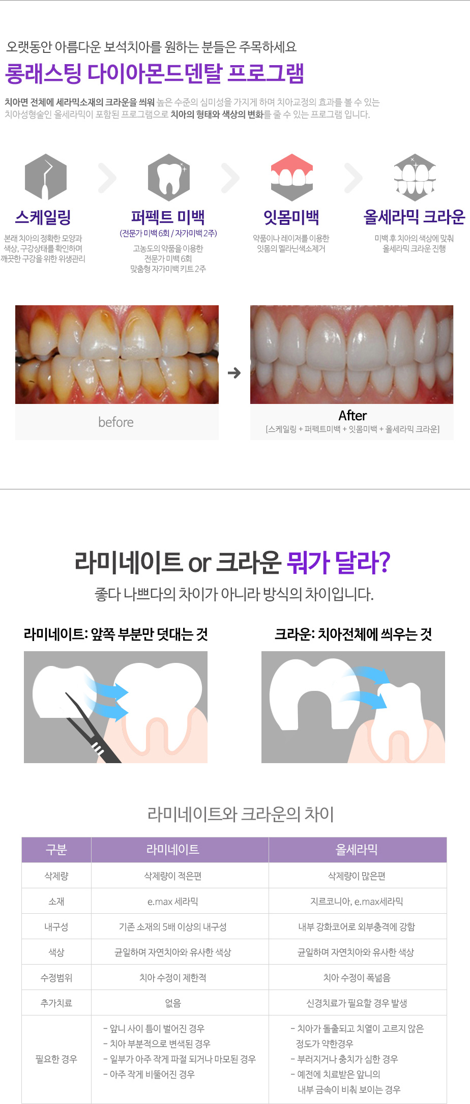 web_dental-beauty_02_02